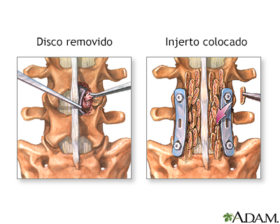Procedimiento (segunda parte)