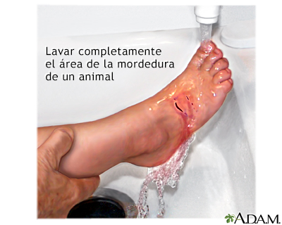 Primeros auxilios en caso de mordeduras de animales - serie