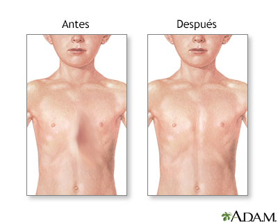 Cuidados postoperatorios