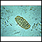 Huevo de Ascaris lumbricoides