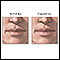 Chapped lips