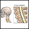 Espondilosis cervical